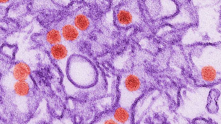 This digitally-colorised electron microscope image shows the Zika virus in red. Photo: Cynthia Goldsmith/CDC via AP