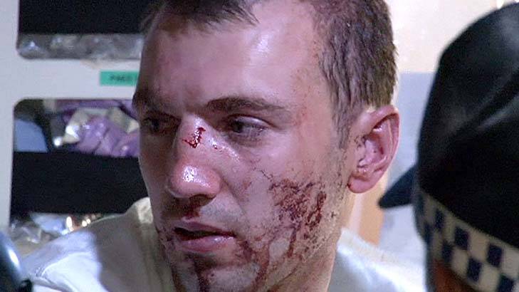 Face of violence: a man bears the scars of an assault at Haymarket on Friday night. Photo: Channel Seven