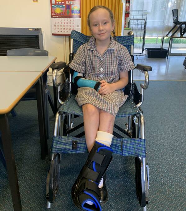 Stella McMillan had to spend a summer in a wheelchair, after a world first operation to replace her forearm bone with her leg bone, following complications with NF. Picture: Supplied.