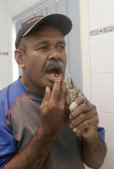 Isikeli made headlines in 2009, when he showcased his unique resolve and took his dentistry into his own hands after feeling let down by the dental services which were available to residents at the time. PHOTO: File